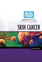 Skin_Cancer